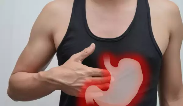 Hiperaciditate gastrică