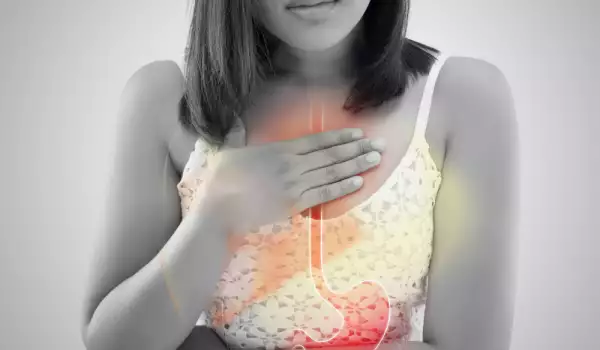 Reflux gastro-esofagian